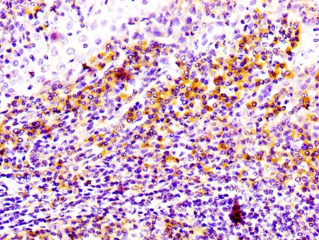 100UL CD81 ANTIBODY 100 ul