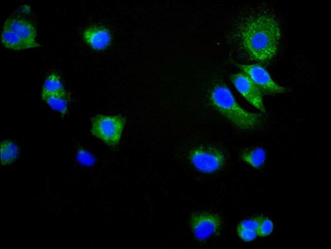 100UL CD9 ANTIBODY 100 ul