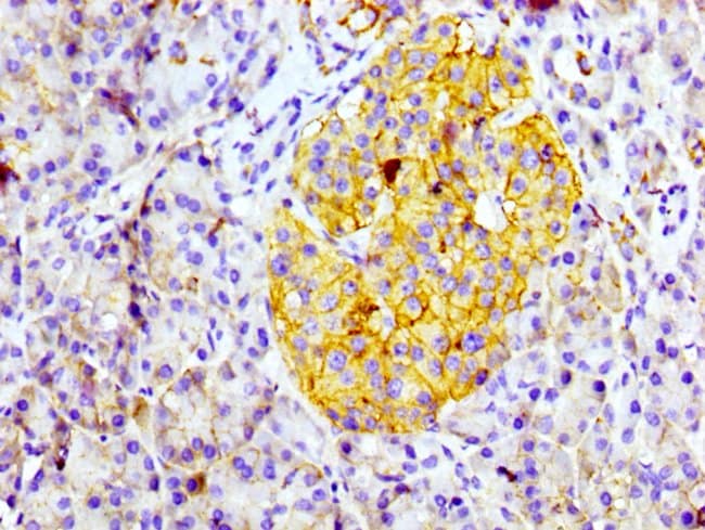 100UL CD99 ANTIBODY 100 ul