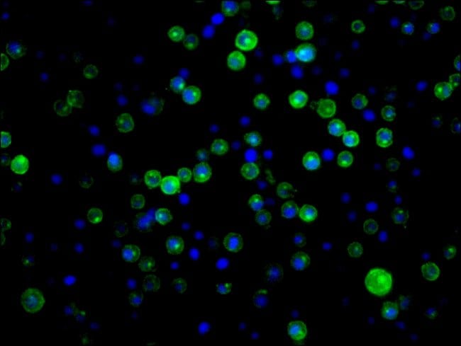 100UL CD21 ANTIBODY 100 ul