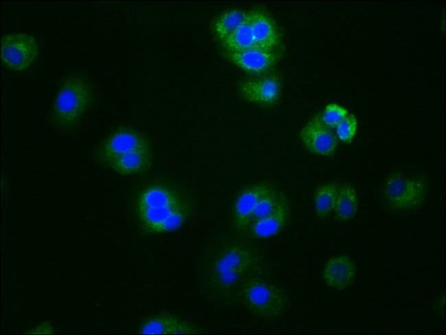100UL AROMATASE ANTIBODY 100 ul