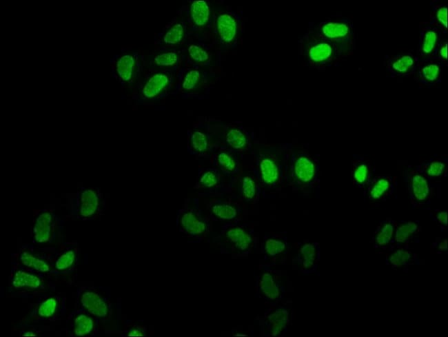 100UL FEN1 ANTIBODY 100 ul