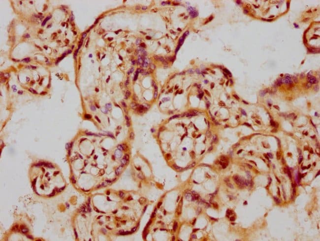100UL GDNF ANTIBODY 100 ul