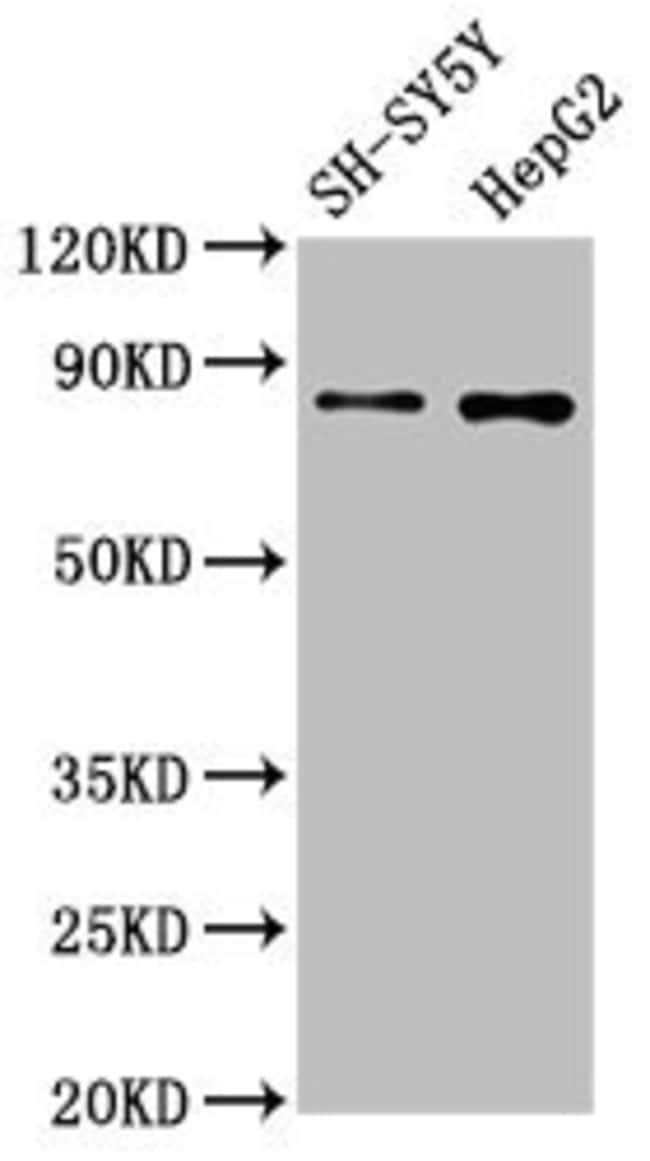 100UL GOLPH2 ANTIBODY 100 ul