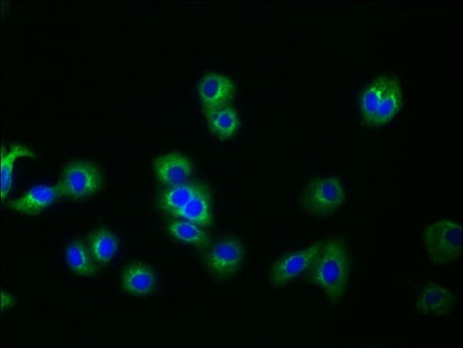 100UL GLYPICAN 3 ANTIBODY 100 ul