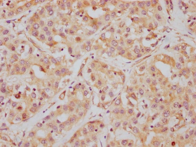 100UL HDAC6 ANTIBODY 100 ul