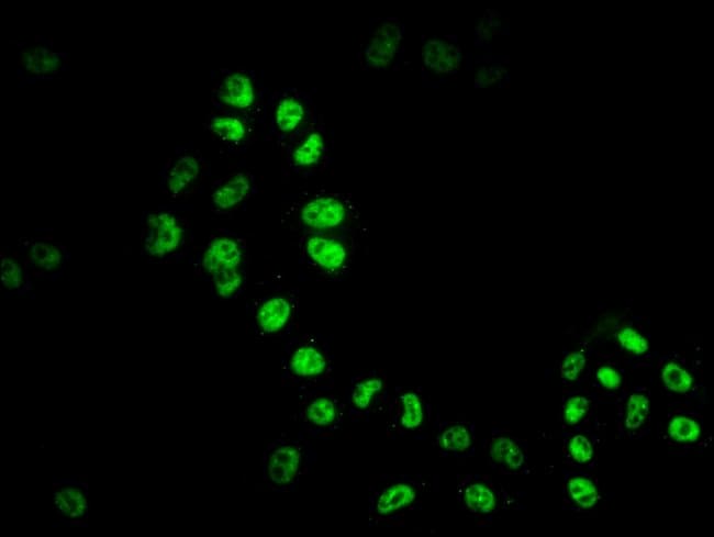 100UL HDAC9 ANTIBODY 100 ul