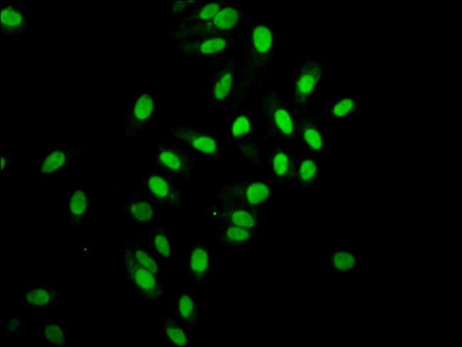 100UL HISTONE H2A ANTIBODY 100 ul