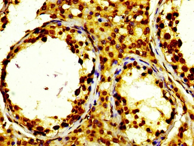100UL HIST1H2BK ANTIBODY 100 ul