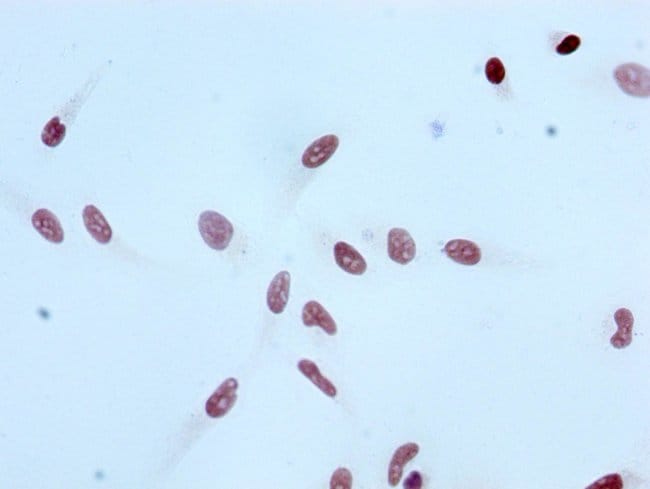 100UL ACETYL-HISTONE H3 (LYS4) ANTIB 100