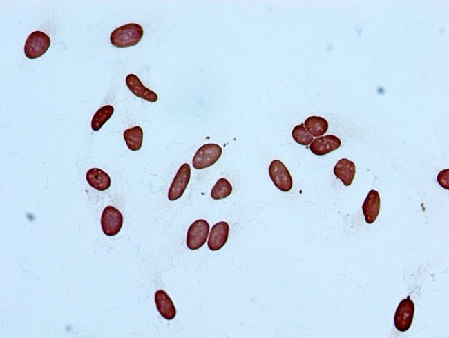 100UL ACETYL-HISTONE H3 (LYS14) ANTI 100