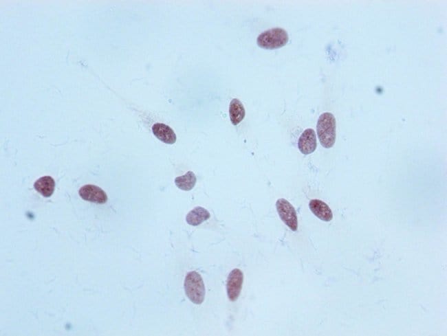 100UL MONO-METHYL-HISTONE H3 (LYS18) 100