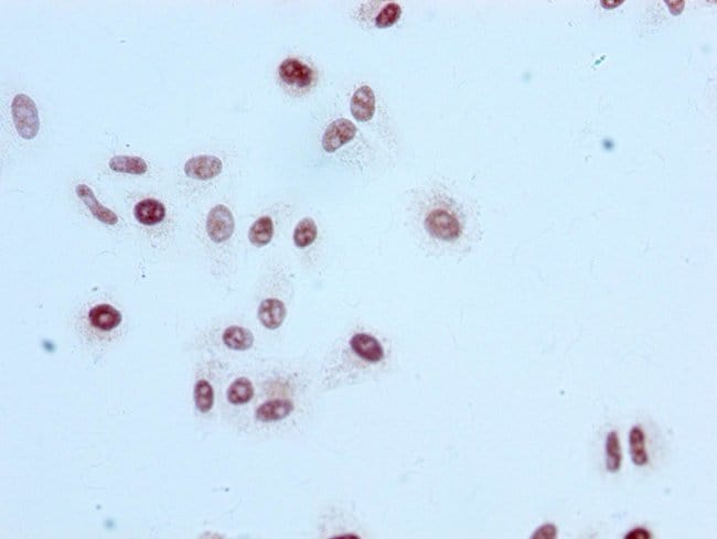 100UL ACETYL-HISTONE H3 (LYS56) ANTI 100