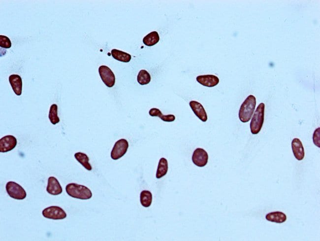 100UL ACETYL-HISTONE H4 (LYS5) ANTIB 100