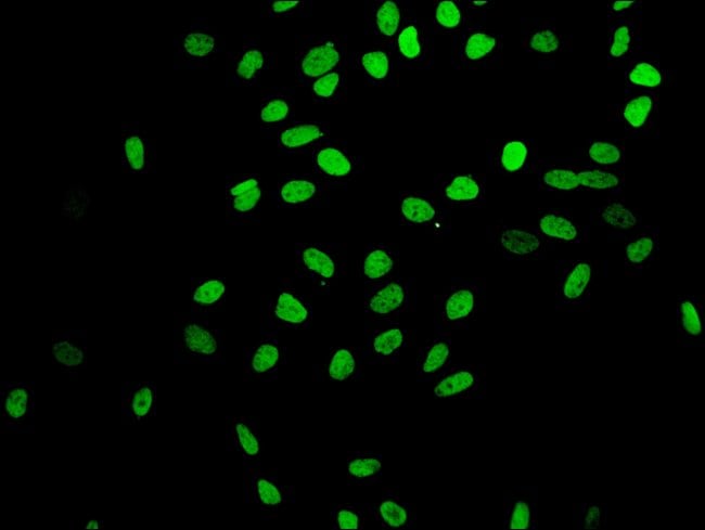 100UL ACETYL-HISTONE H4 (LYS16) ANTI 100