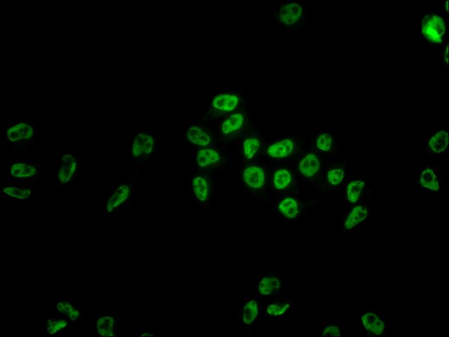 100UL HNRNP C ANTIBODY 100 ul