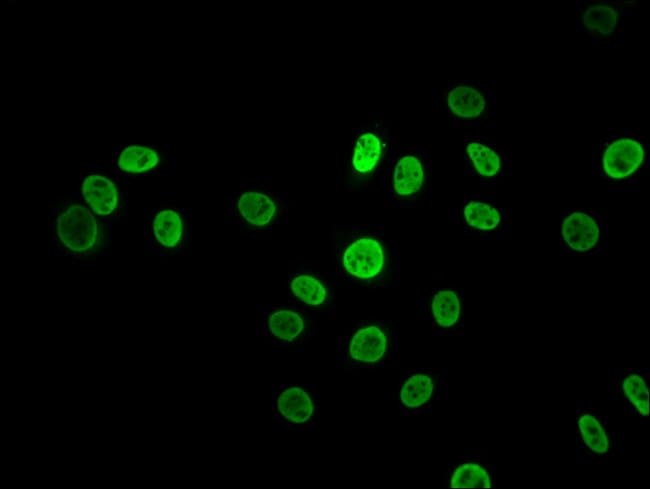 100UL HNRNP K ANTIBODY 100 ul