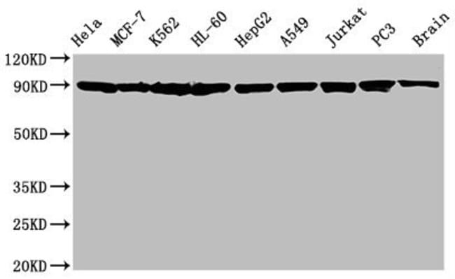 100UL HSP90 ALPHA/BETA ANTIBODY 100 ul