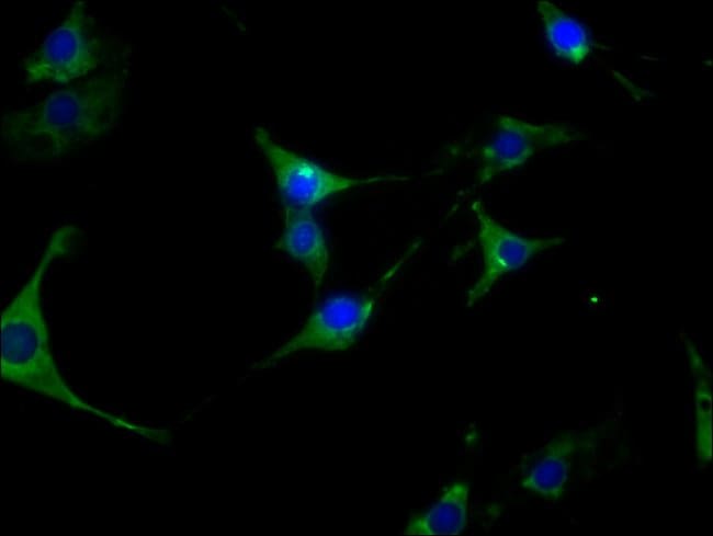 100UL HSP90 ALPHA ANTIBODY 100 ul