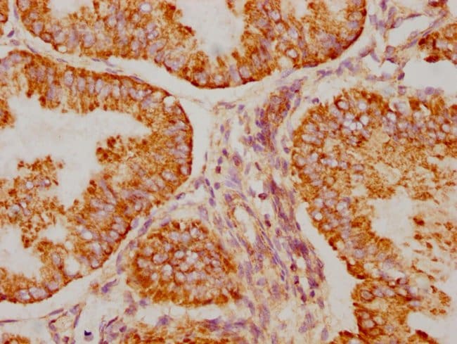 100UL BAK ANTIBODY 100 ul