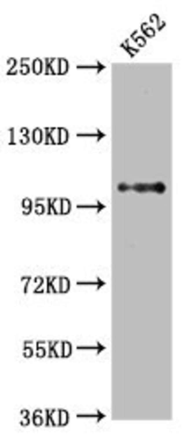 100UL DGCR8 ANTIBODY 100 ul