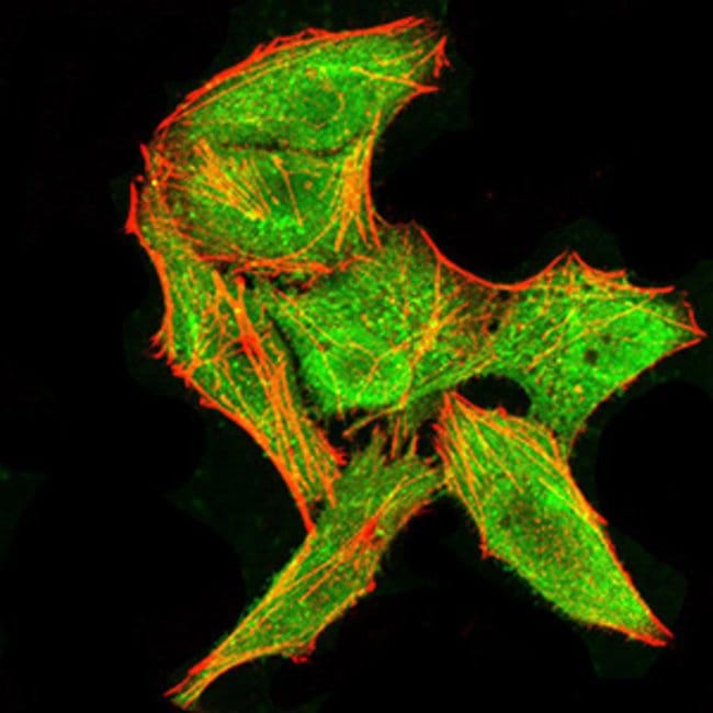 100UG DDX3 Monoclonal Antibody (3B9E3)