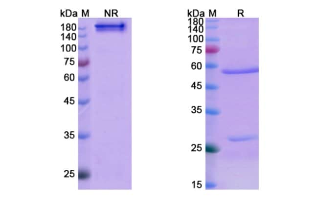 100UG DENOSUMAB ANTIBODY 100 UG