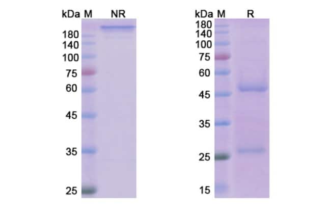 100UG RESLIZUMAB ANTIBODY 100 UG
