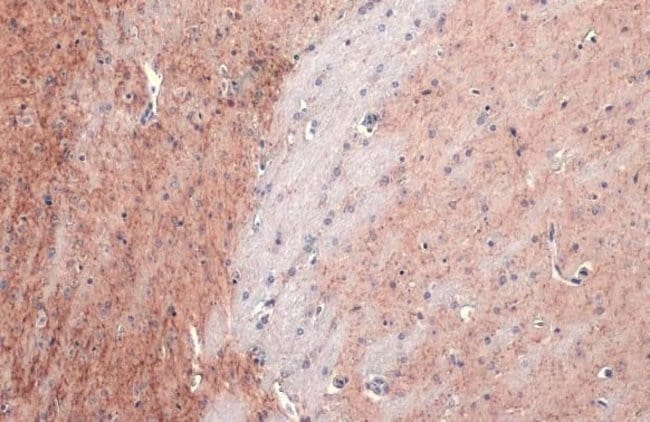 100UL ACETYLCHOLINESTERASE ANTIBODY 100
