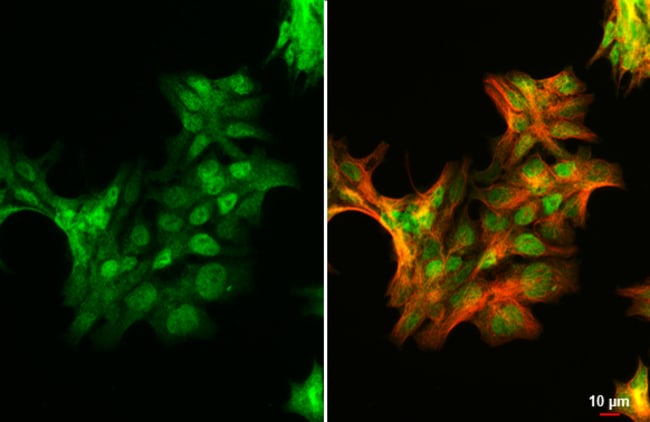 100UL ANDROGEN RECEPTOR (ARV7 SPLICE 100
