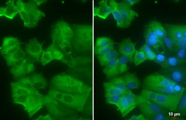 100UL AGR2 ANTIBODY 100 UL