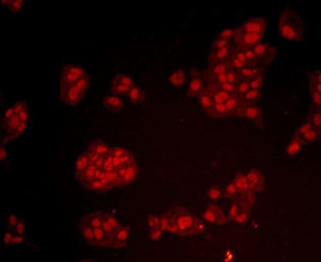 100UL BMI-1 ANTIBODY 100 UL
