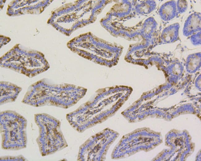 100UL ALPL ANTIBODY 100 UL