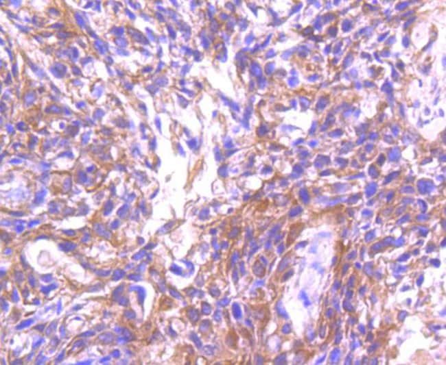 100UL ASK1 ANTIBODY 100 UL