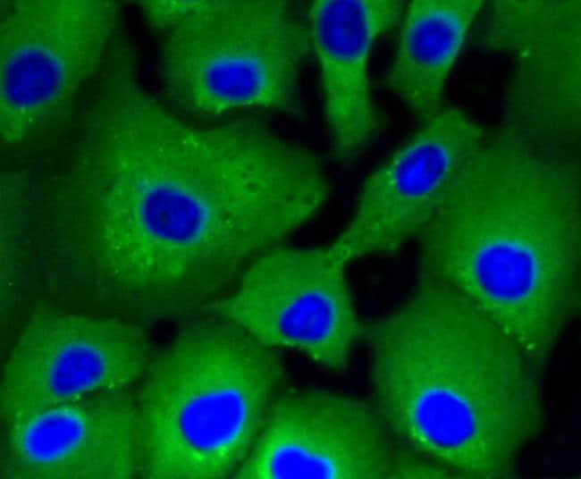 100UL ATP CITRATE LYASE ANTIBODY 100 UL