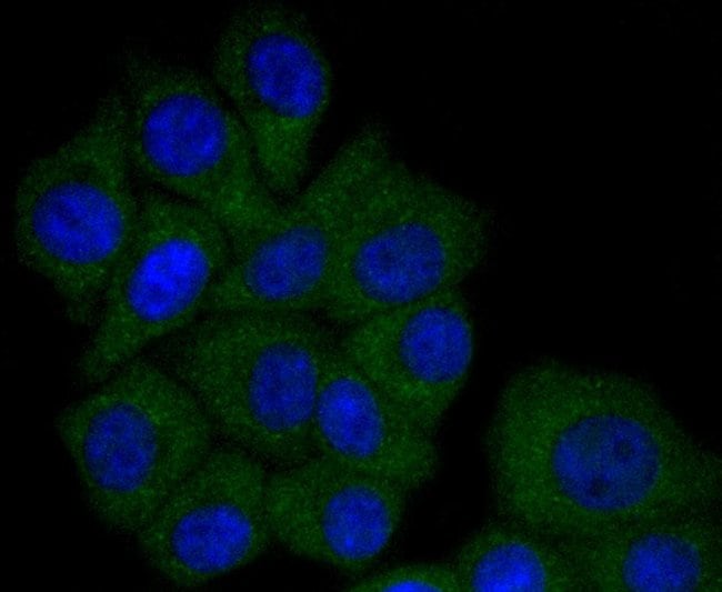 100UL APOA1 ANTIBODY 100 UL