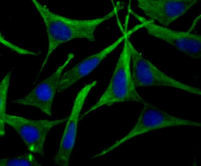 100UL APOA2 ANTIBODY 100 UL