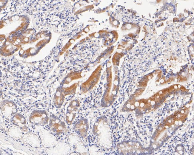 100UL ABH1 ANTIBODY 100 UL