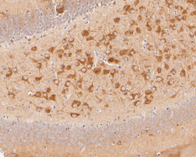 100UL ACSL4 ANTIBODY 100 UL