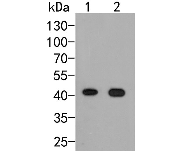 100UL ARL13B ANTIBODY 100 UL