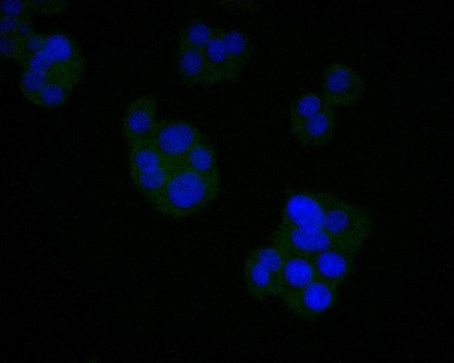 100UL AGTR1 ANTIBODY 100 UL