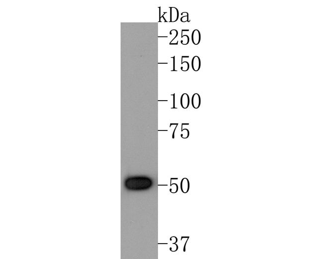 100UL ACVR2B ANTIBODY 100 UL