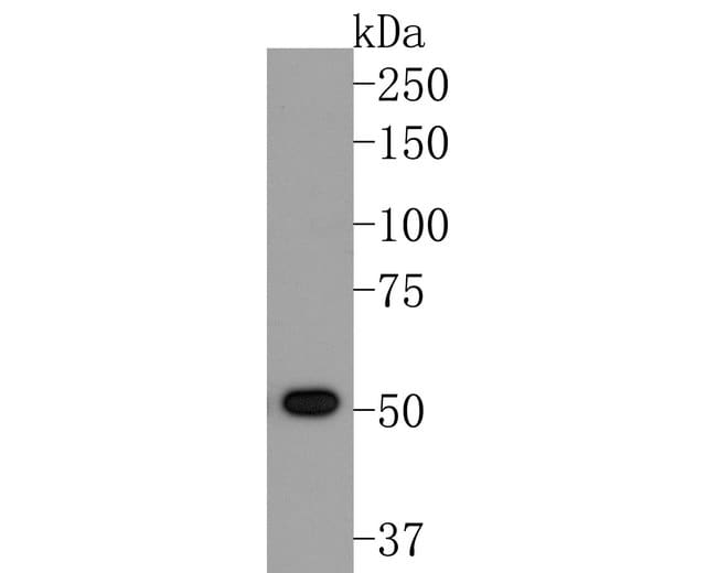 100UL ACVR2B ANTIBODY 100 UL