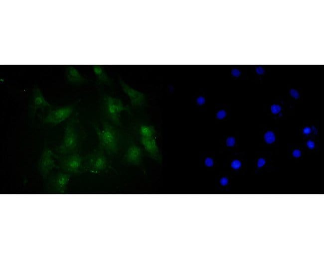 100UL AMPK ALPHA-2 ANTIBODY 100 UL