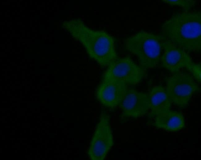 100UL A2M ANTIBODY 100 UL