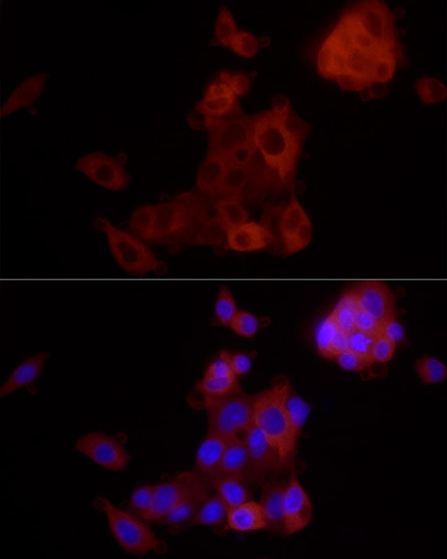 100UL ALDH1A1 ANTIBODY 100 UL