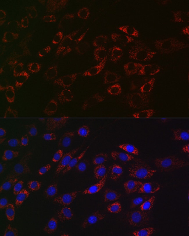 100UL ACAA2 ANTIBODY 100 UL