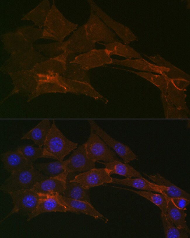 100UL ATP1A1 ANTIBODY 100 UL