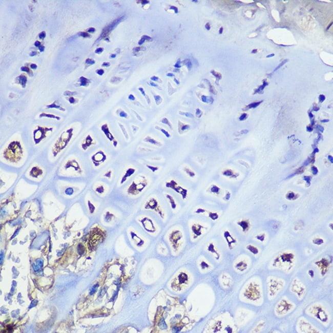 100UL AGGRECAN ANTIBODY 100 UL