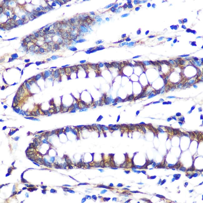 100UL AROMATASE ANTIBODY 100 UL